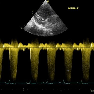 https://www.cliniqueveterinairedugolfe.fr/wp-content/uploads/2020/02/doppler-mitral-400x400.jpg