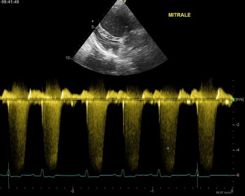 https://www.cliniqueveterinairedugolfe.fr/wp-content/uploads/2020/02/doppler-mitral-500x400.jpg